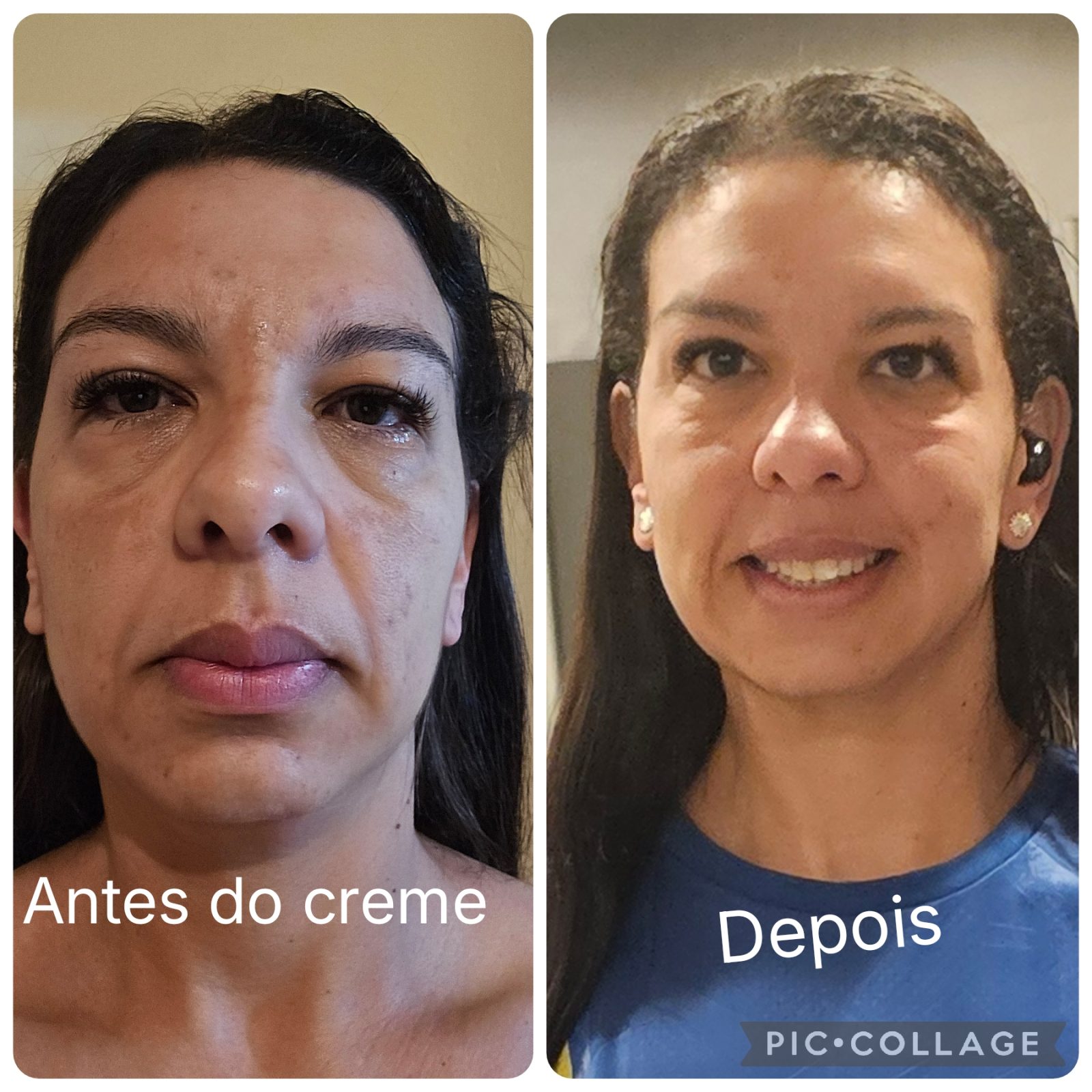 Protocolo de clareamento com o produto da Hidratei